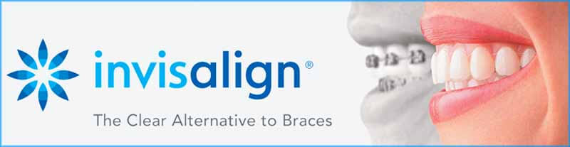 Invisalign in Winnnipeg