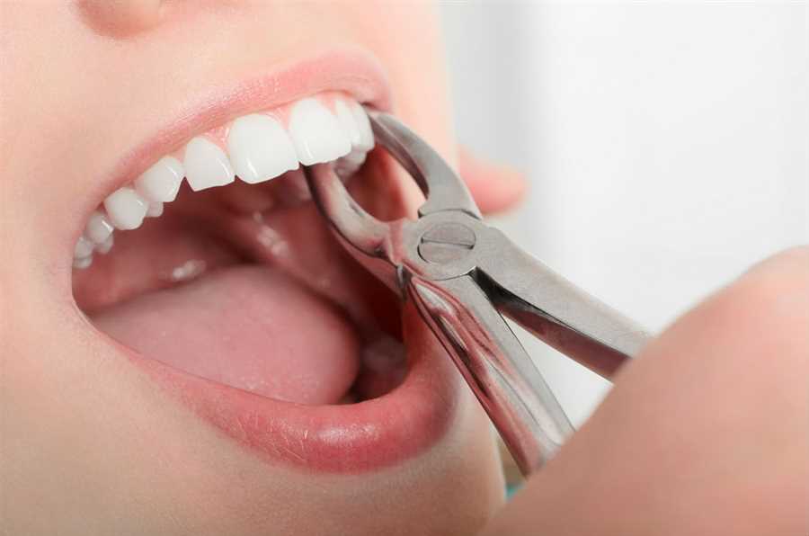 Patient going through tooth extractions in Winnipeg