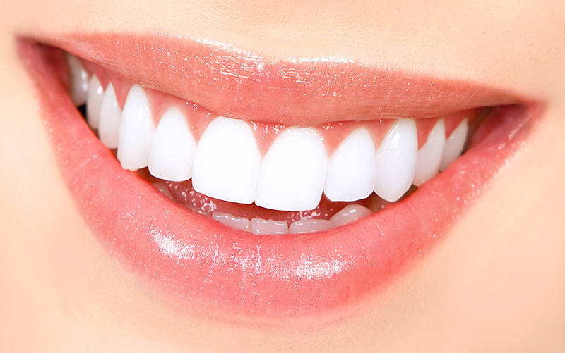Patient showing beautiful smile after getting teeth whitening in Winnipeg